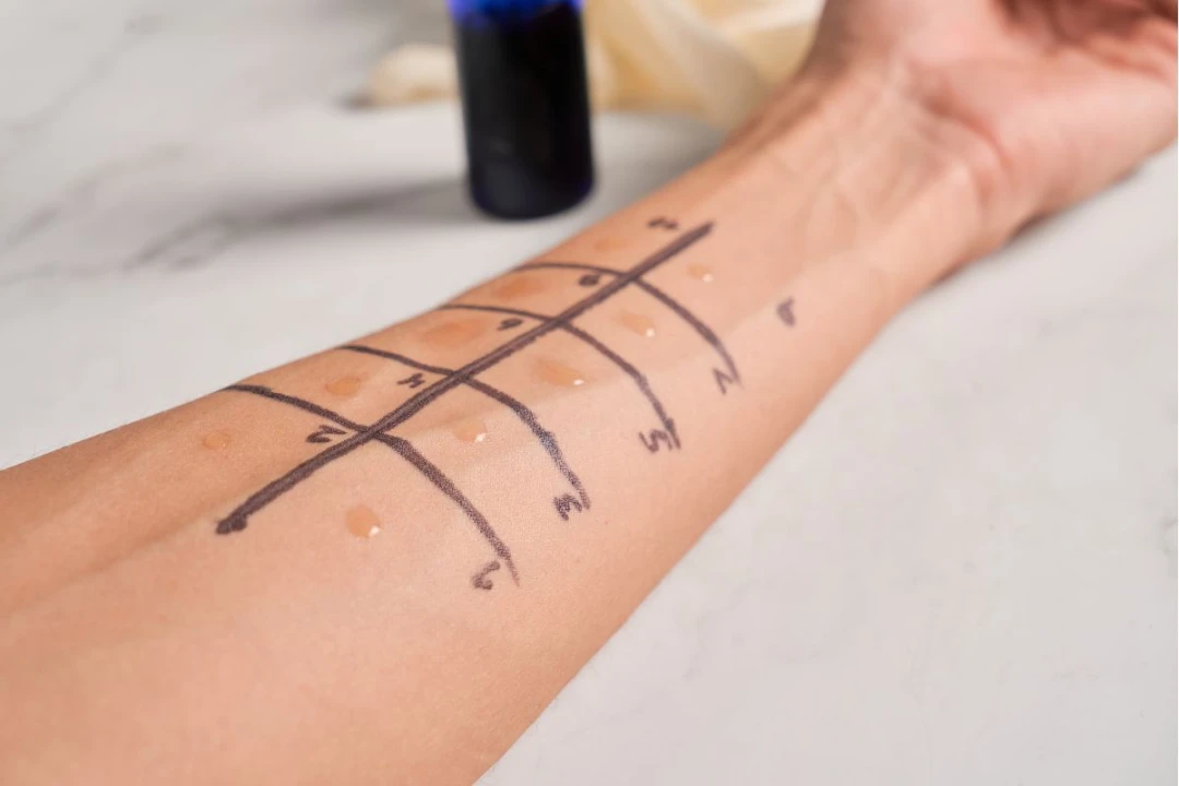 alergolog białystok